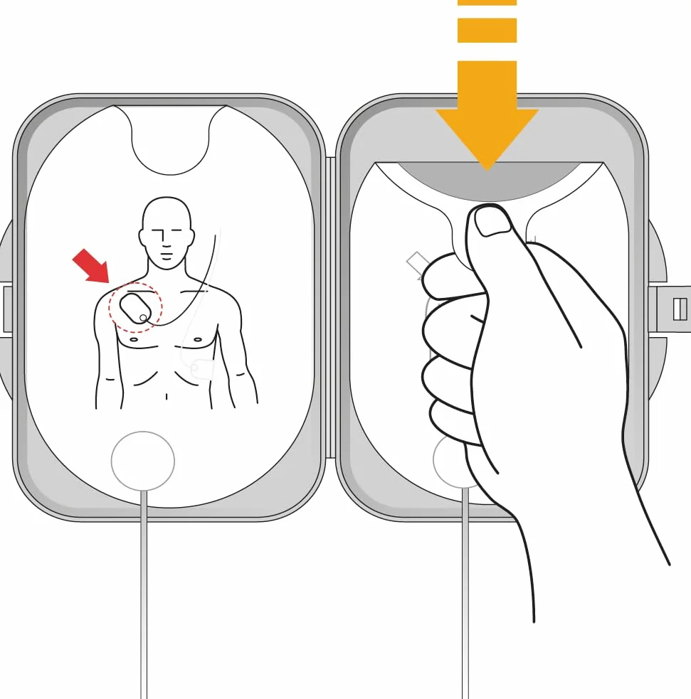 Philips HeartStart FRx SMART Pads II